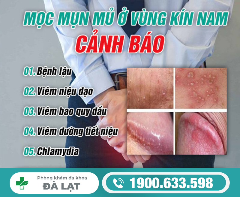 Hình ảnh minh họa